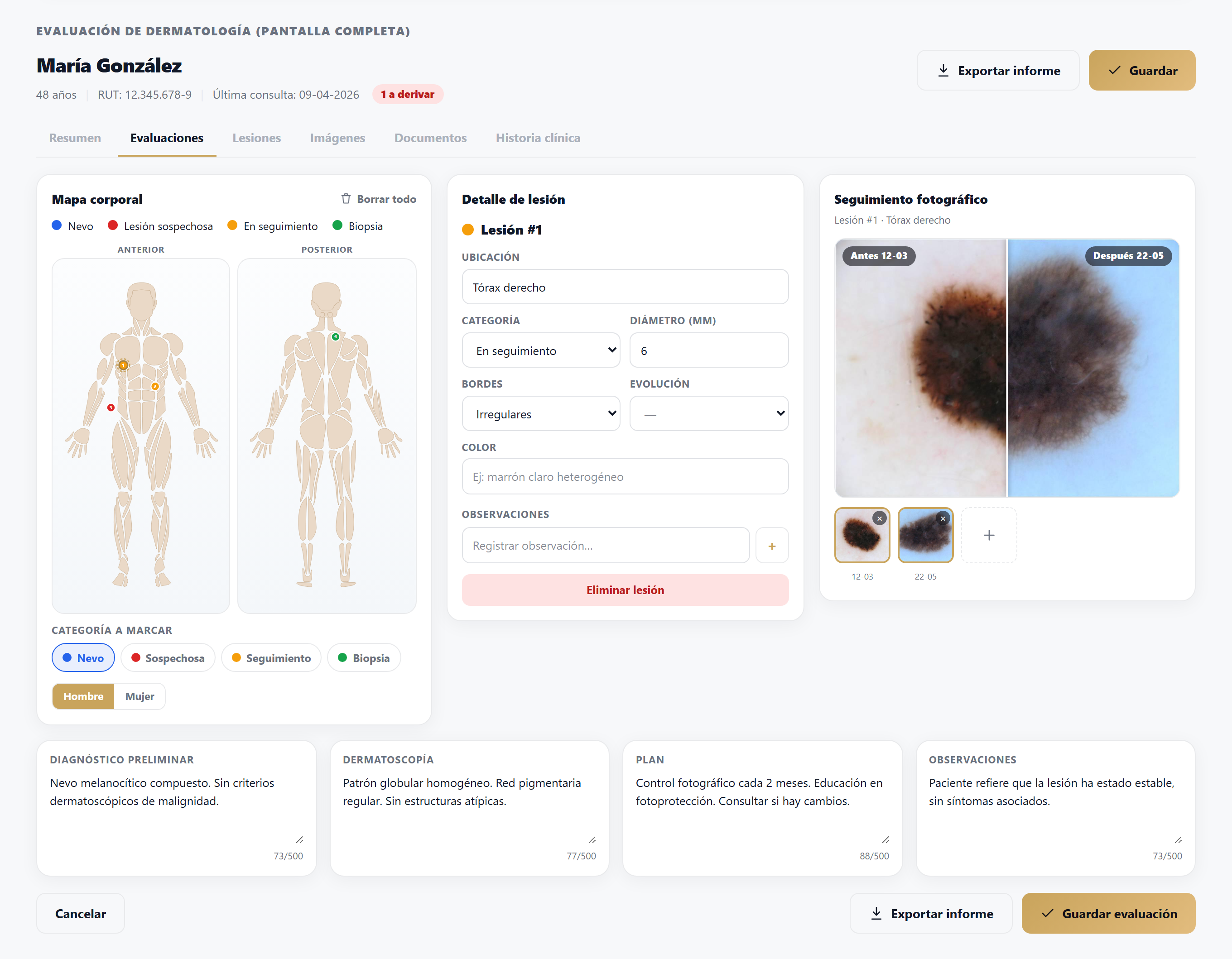 Mapa corporal y seguimiento de lesiones en el módulo de dermatología