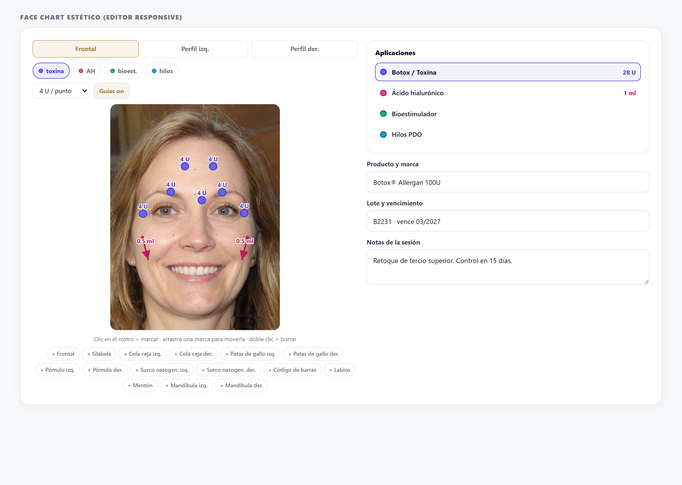 Face chart con trazabilidad real